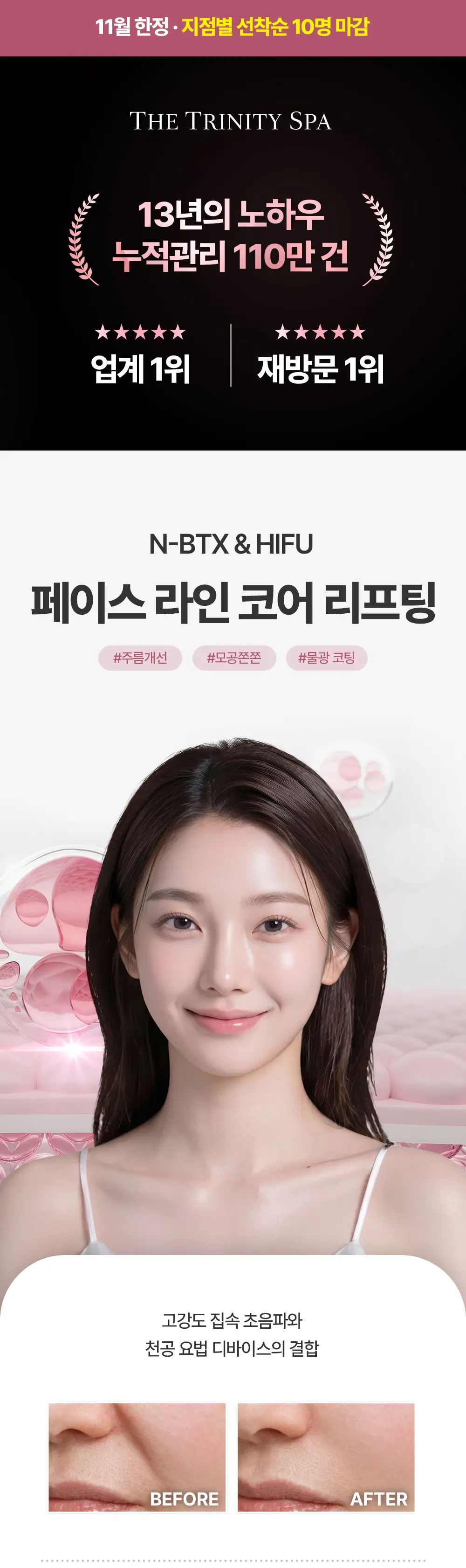 20261027_상세페이지_페이스라인코어리프팅_01.jpg